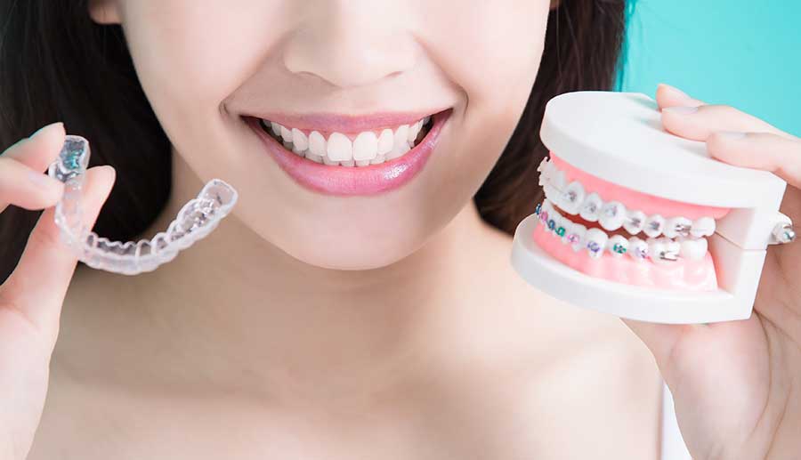 آیا به ارتودنسی دندان نیاز داریم؟