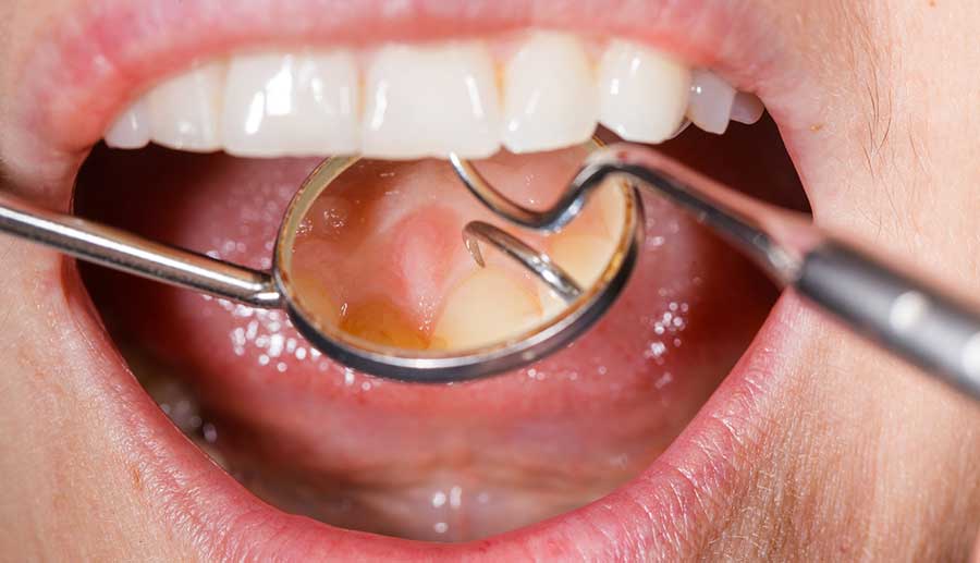 5 علائم دندانی که هرگز نباید نادیده گرفته شوند