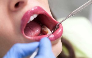 جراحی دهان و دندان در رشت